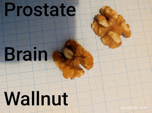 Going Nuts about Your Health